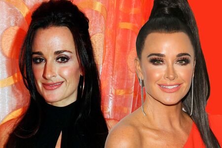 Kyle Richards before and after plastic surgery.