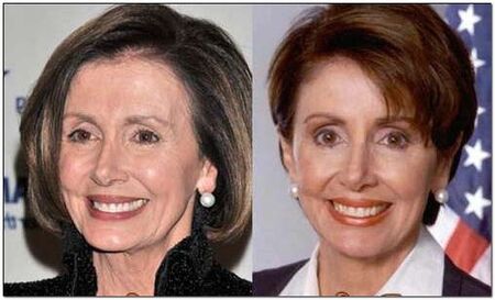 Nancy Pelosi before and after plastic surgery.