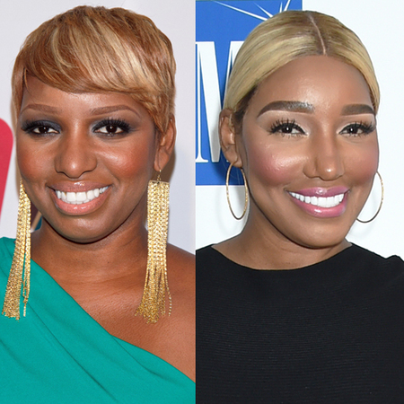 NeNe Leakes before and after plastic surgery.