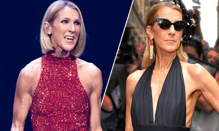 Celine Dion before and after weight loss.