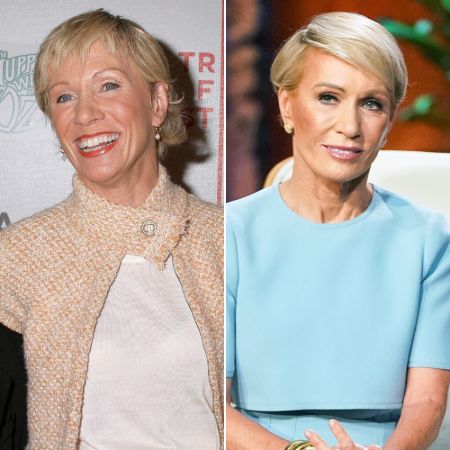 Barbara Corcoran before and after plastic surgery.