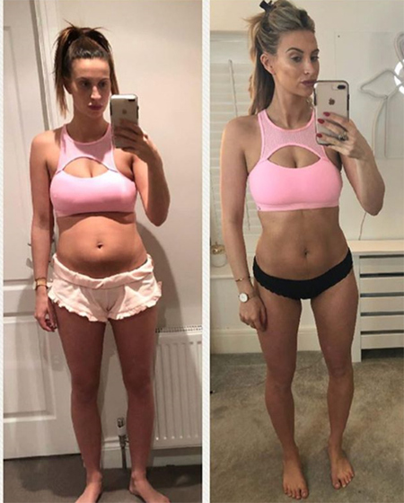 Ferne McCann before and after weight loss.