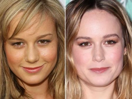 Brie Larson's first plastic surgery was a nose job in 2009.