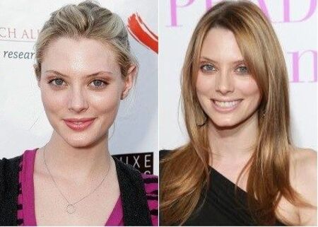 April Bowlby before and after alleged plastic surgery.