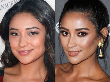 Shay Mitchell before and after plastic surgery.