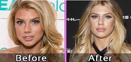 Charlotte McKinney before and after plastic surgery.