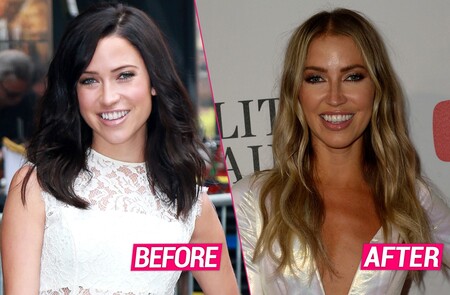 Kaitlyn Bristowe before and after alleged plastic surgery.