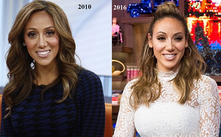 Melissa Gorga before and after her nose job.