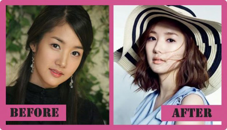 Park Min-young before and after plastic surgery.