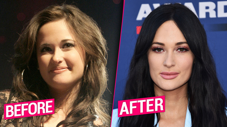 Kacey Musgraves before and after plastic surgery.