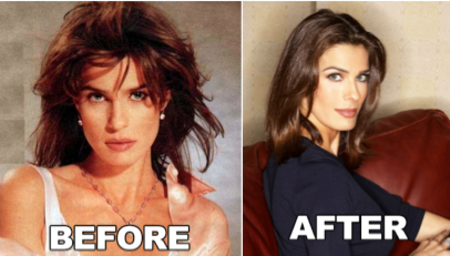 Kristian Alfonso before and after alleged plastic surgery.