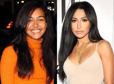 Naya Rivera before and after plastic surgery.