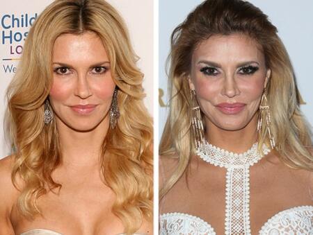 Brandi Glanville before and after plastic surgery.