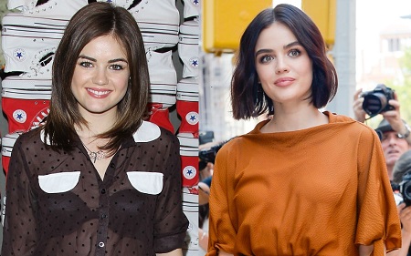 Lucy Hale before and after alleged plastic surgery, most notably lip fillers.