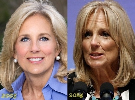 Real Truth About Jill Biden's Plastic Surgery Speculations