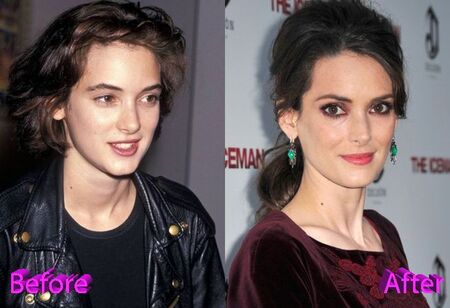 Winona Ryder before and after alleged plastic surgery.