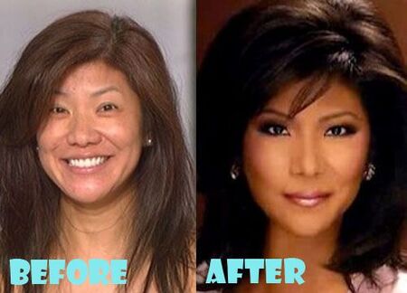 Julie Chen before and after an alleged nose job plastic surgery.