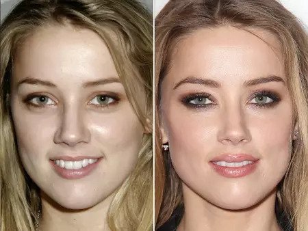 Amber Heard before and after alleged plastic surgery.