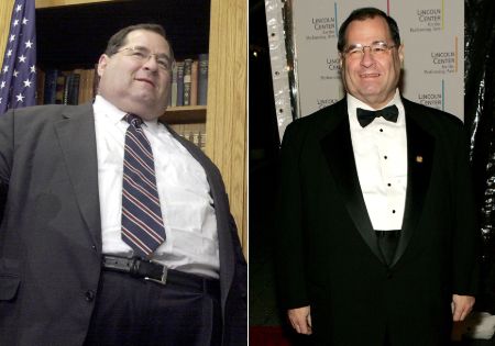 Jerry Nadler before and after weight loss surgery.