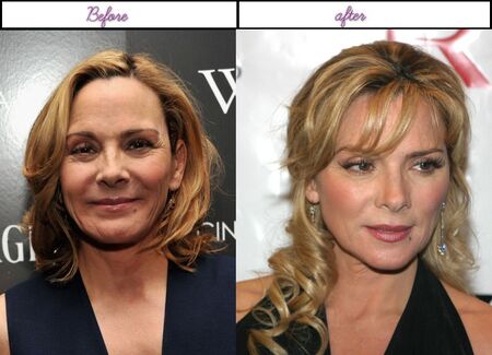 Kim Cattrall before and after alleged plastic surgery.