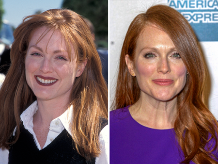 Julianne Moore before and after alleged plastic surgery.