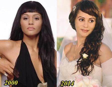 Persia White before and after plastic surgery.