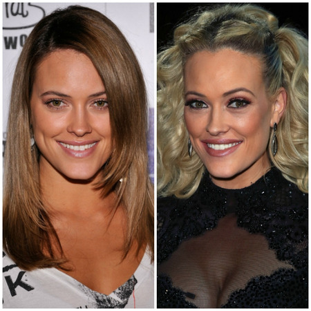 Peta Murgatroyd before and after plastic surgery.