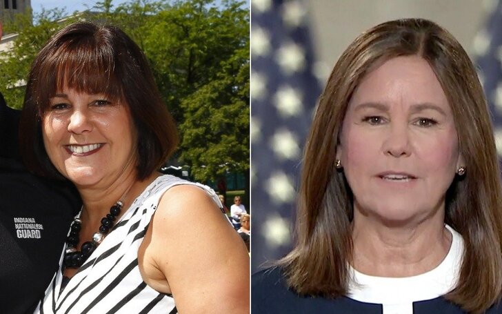 Karen Pence before and after plastic surgery.