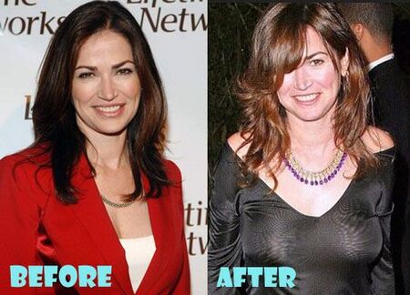 Kim Delaney before and after plastic surgery.