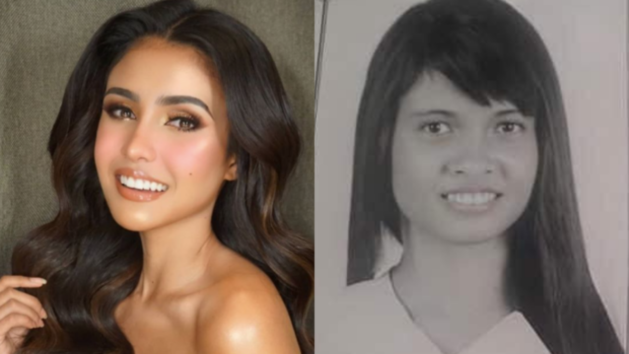 Rabiya Mateo is accused of plastic surgery through before and after images.