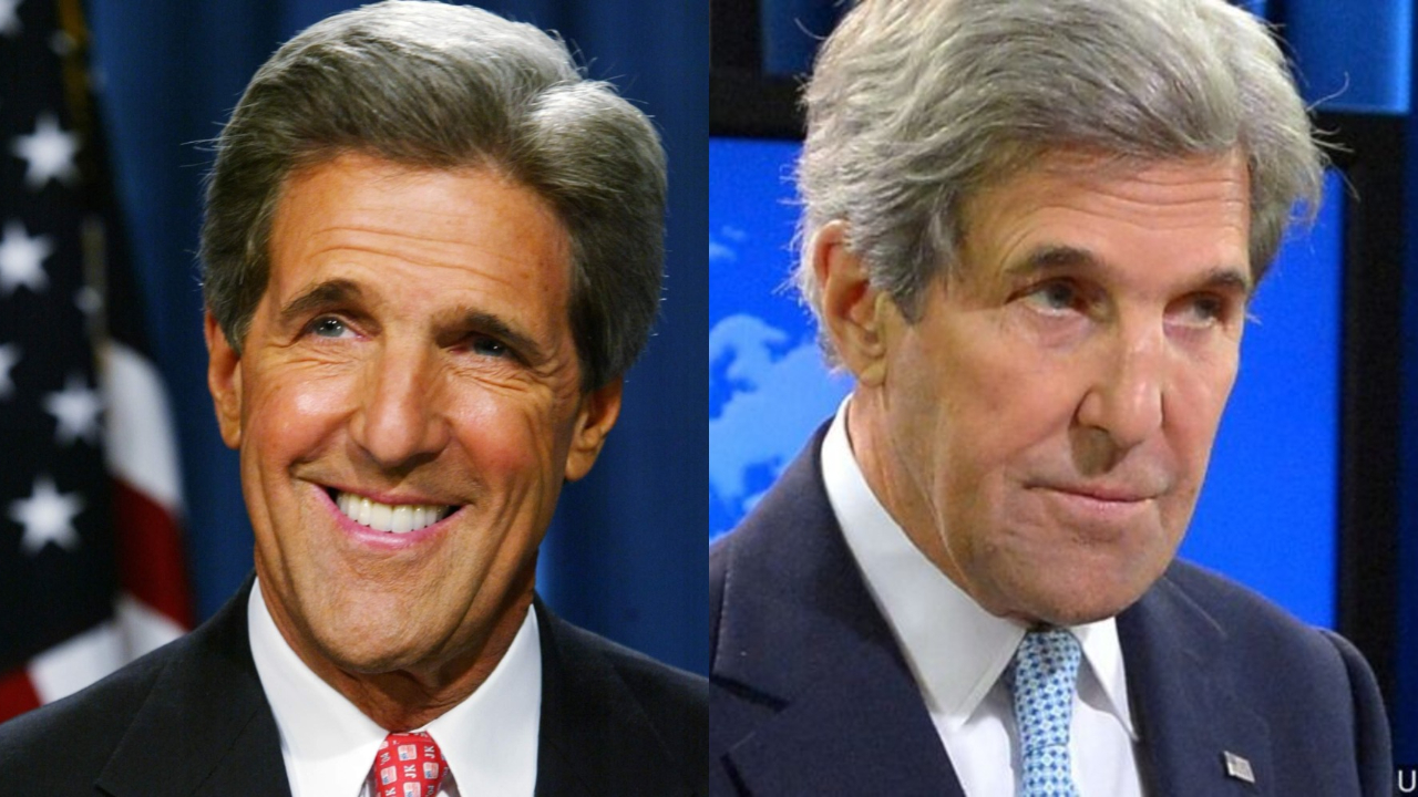 John Kerry's plastic surgery includes Botox.