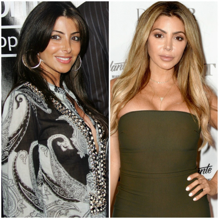 Larsa Pippen before and after plastic surgery.