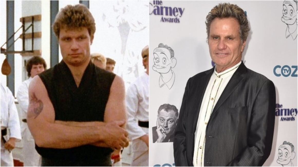 Martin Kove before and after plastic surgery.