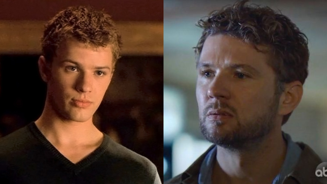 Ryan Phillippe before and after plastic surgery.