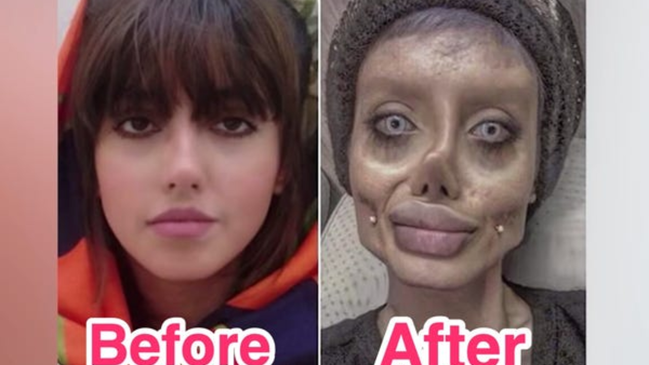 Sarah Taber before and after plastic surgery.