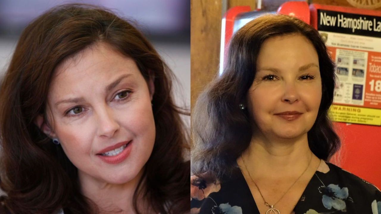 Ashley Judd's plastic surgery includes Botox injections.