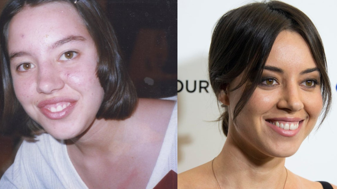 Real Truth About Aubrey Plaza's Plastic Surgery Speculations