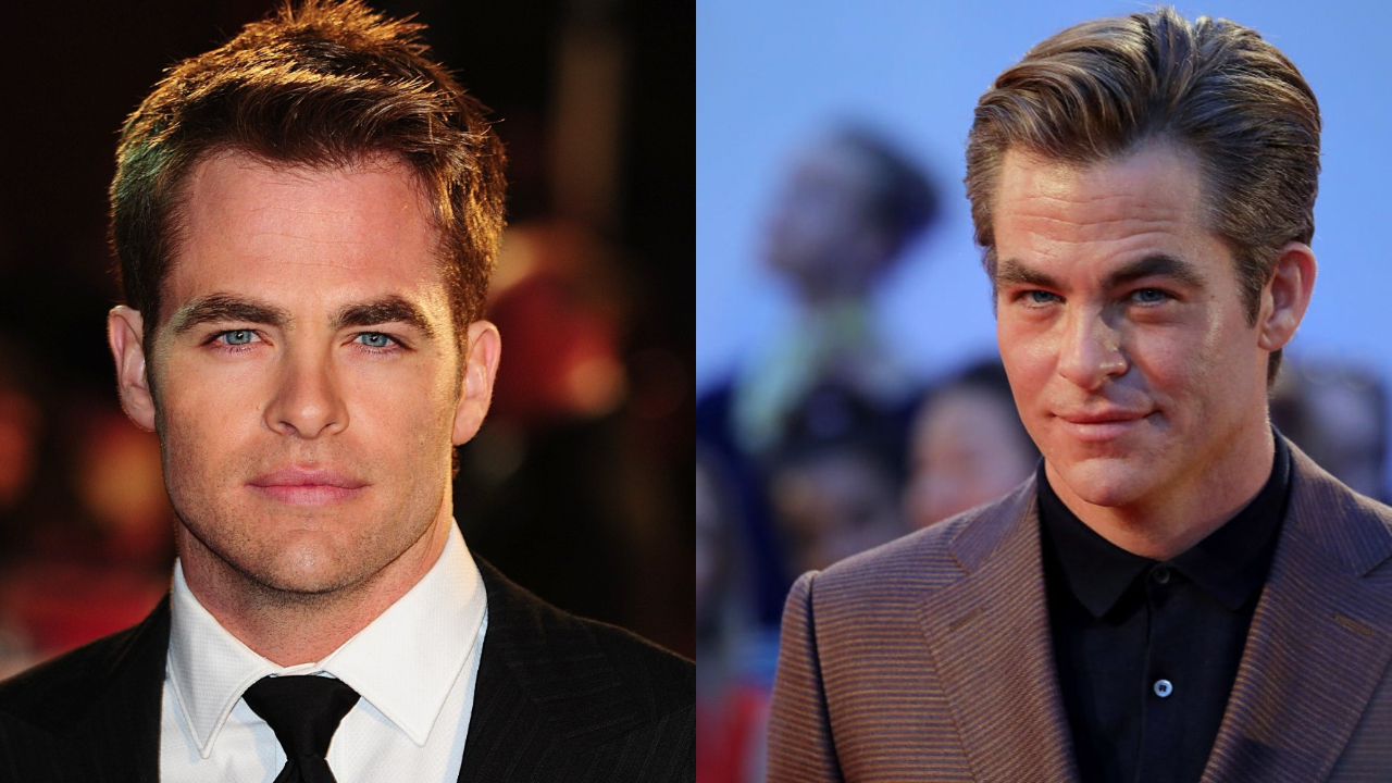 Chris Pine before and after alleged plastic surgery on lips and face, most notably Botox.