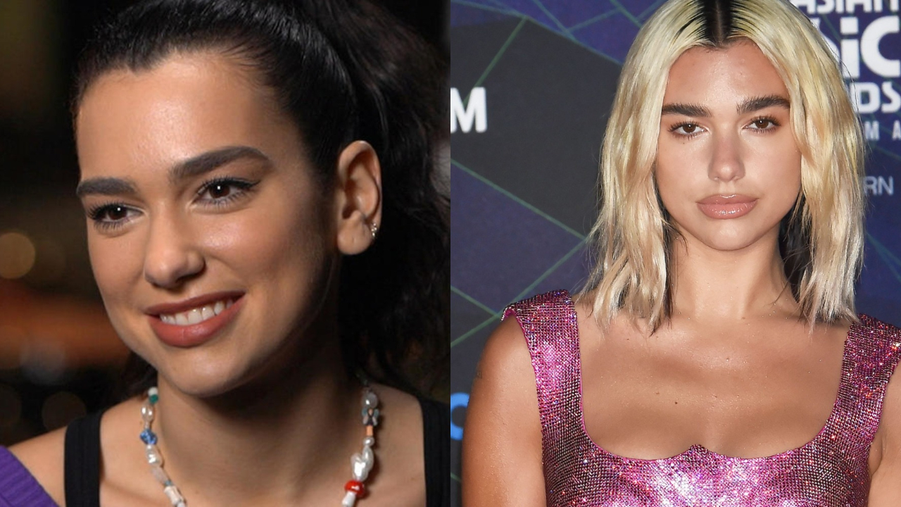 Dua Lipa is at the forefront of plastic surgery speculations on the internet.