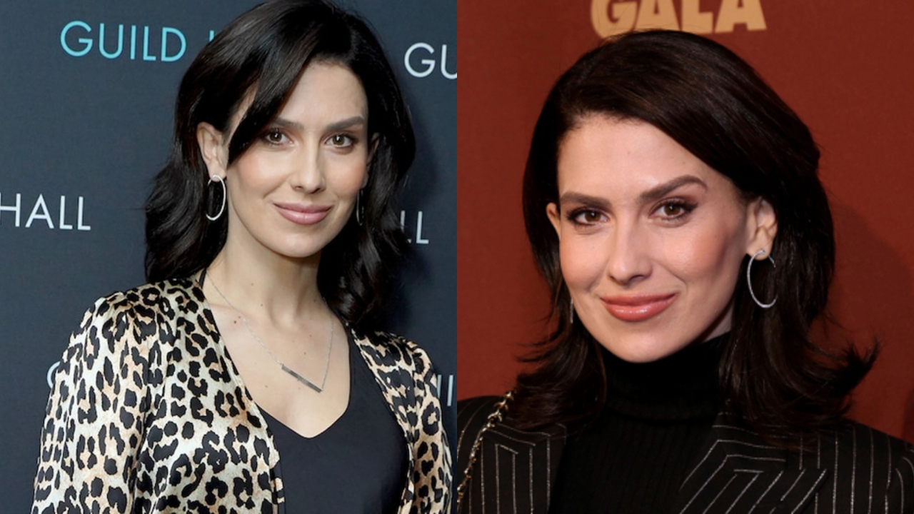 Hilaria Baldwin before and after alleged plastic surgery.