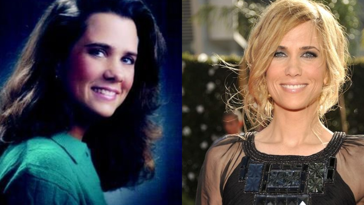 SNL alum Kristen Wiig before and after suspected plastic surgery.