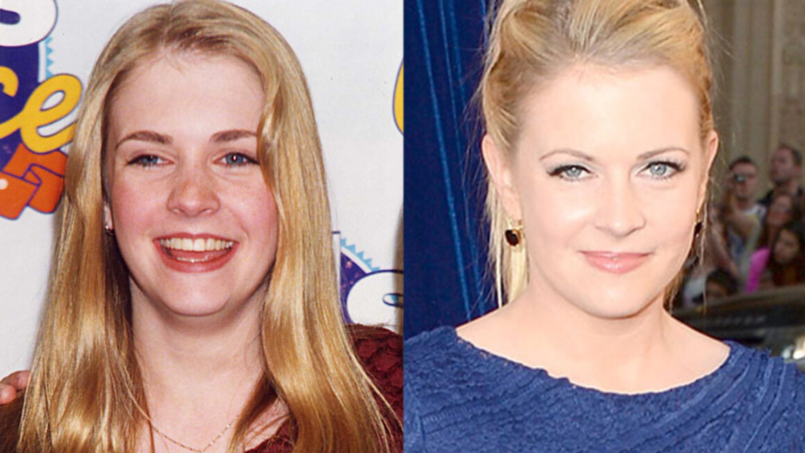 Melissa Joan Hart before and after plastic surgery.