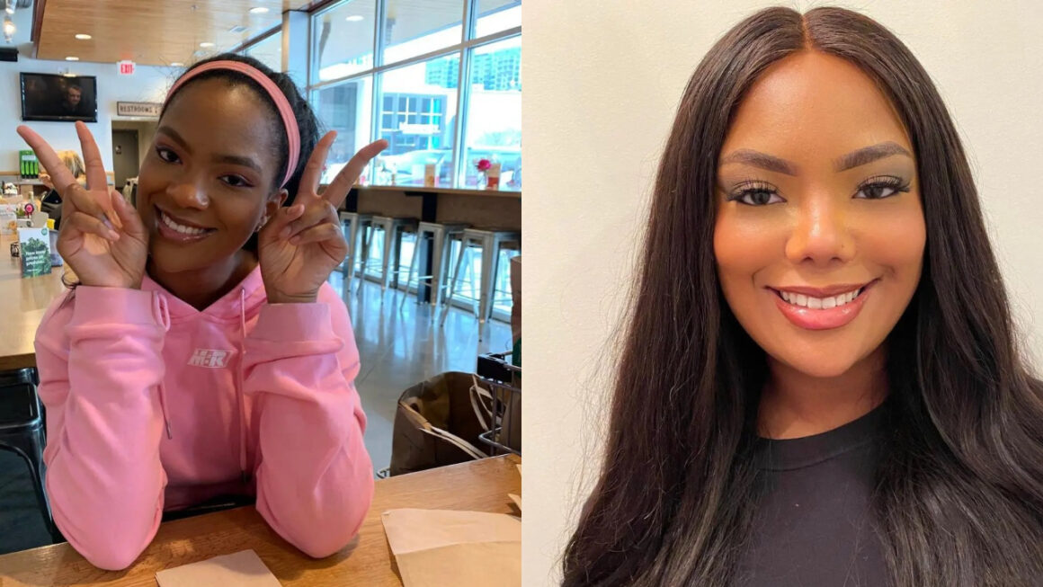 Riley Burruss before and after nose job plastic surgery.