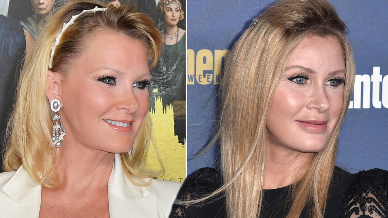 Sandra Lee's plastic surgery includes Botox injections.