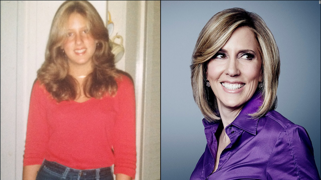 Alisyn Camerota before and after plastic surgery.