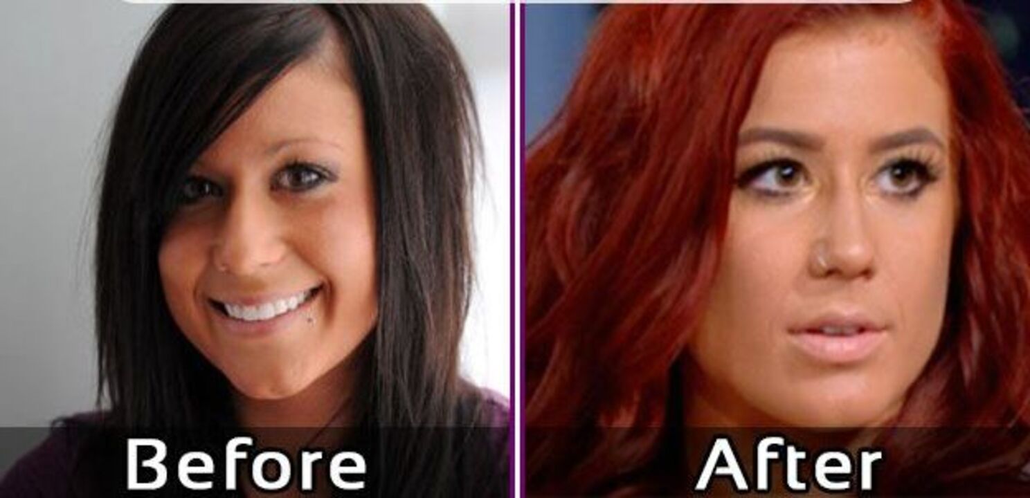 Chelsea Houska before and after plastic surgery.