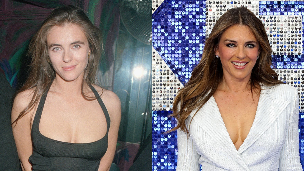 Elizabeth Hurley before and after plastic surgery.