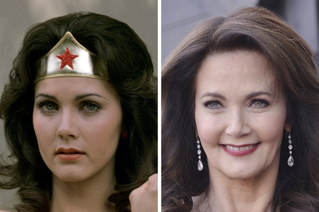 Lynda Carter before and after plastic surgery, notably Botox and facelift.