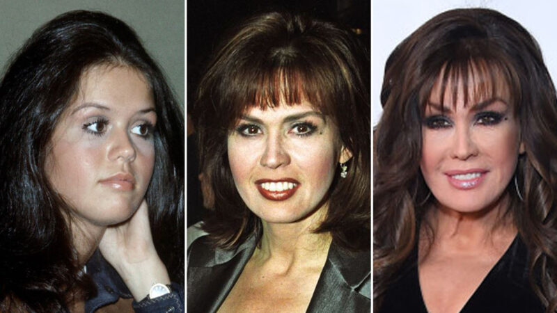 Marie Osmond Plastic Surgery - Use of Enhancements and Weight Loss Journey