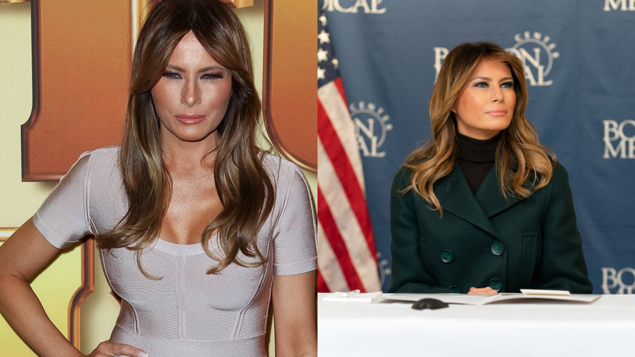 Melania Trump before and after weight loss.